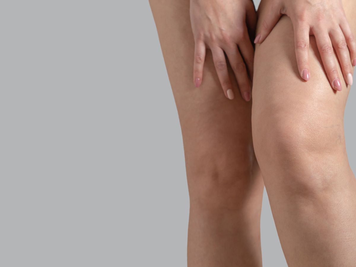 Natural Ways to Lose Water Retention After Pregnancy